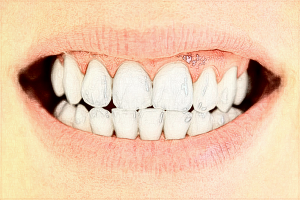 武漢大學(xué)口腔醫(yī)院口腔科醫(yī)生好嗎?2024口腔科收費(fèi)價(jià)目表