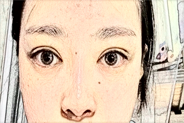 2024天津人民醫(yī)院激光祛斑怎么樣？案例價格一覽