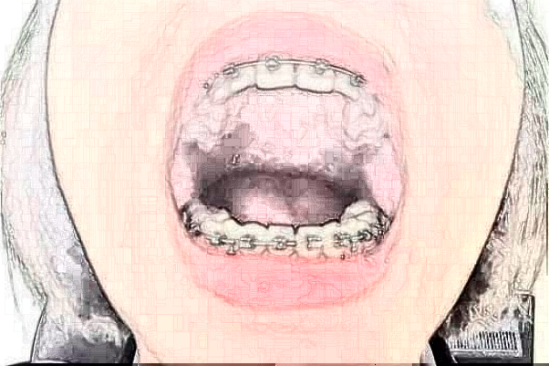 蘇州牙科醫(yī)院排行榜前五強揭曉!2024哪家技術(shù)好？