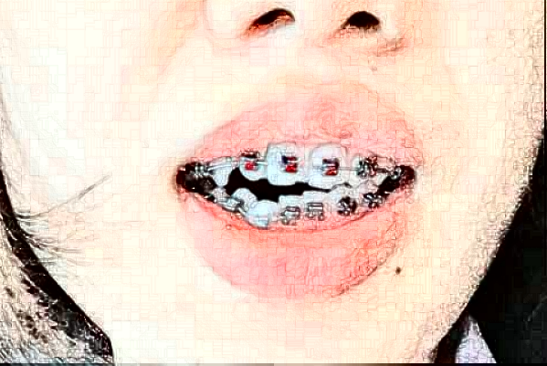 蘇州牙科醫(yī)院排行榜前五強揭曉!2024哪家技術(shù)好？