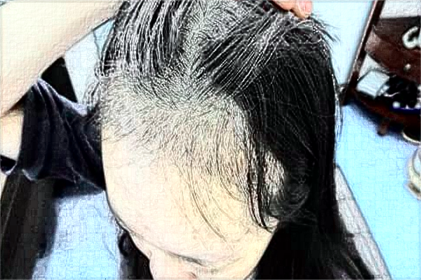 2024蘇州大學(xué)附屬第一醫(yī)院植發(fā)做的好嗎_醫(yī)生推薦