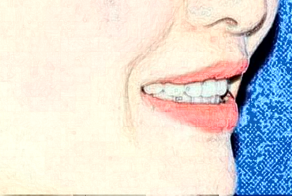 天津市口腔醫(yī)院根管多少錢(qián)_做的好嗎？