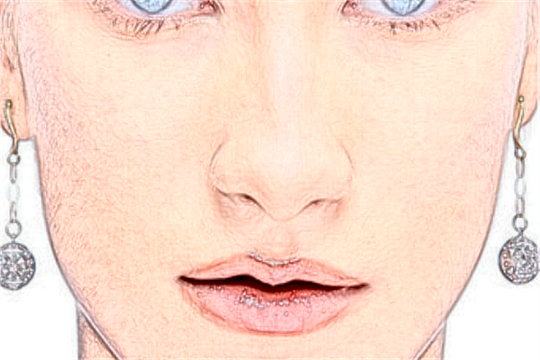 泉州180醫(yī)院激光脫毛貴嗎?2024激光脫毛多少錢?