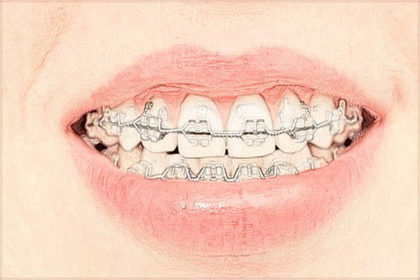 珠海市人民醫(yī)院牙醫(yī)好不好?2024牙醫(yī)收費(fèi)價(jià)格如何