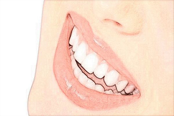 2024泉州180醫(yī)院矯正牙齒貴嗎?矯正牙齒臉型會(huì)變嗎