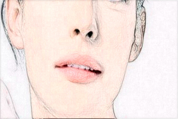 2024阜陽市人民醫(yī)院填充做的好嗎？哪位醫(yī)生名氣大