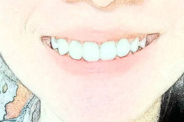 2024蘇州第四人民醫(yī)院牙科怎么樣_附醫(yī)生名單詳情介紹