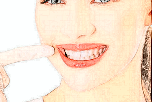 天津市第一中心醫(yī)院牙齒矯正做的好嗎？醫(yī)生排名