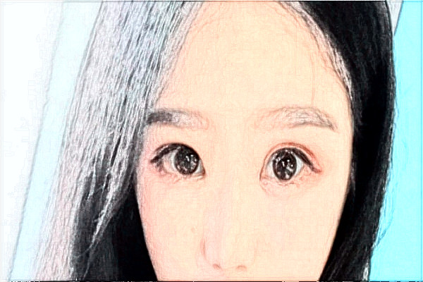 天津市第一中心醫(yī)院祛斑多少錢(qián)?祛斑日記分享