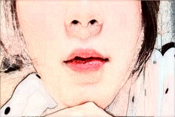 天津市第一中心醫(yī)院祛斑多少錢(qián)?祛斑日記分享