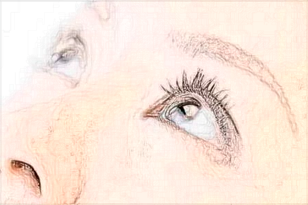 2024山東省千佛山醫(yī)院近視手術(shù)價(jià)格?近視手術(shù)后遺癥