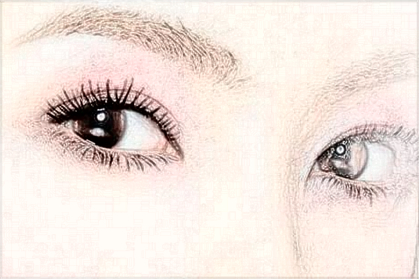 泉州180醫(yī)院做雙眼皮埋線好還是割的好?雙眼皮埋線能保持多久