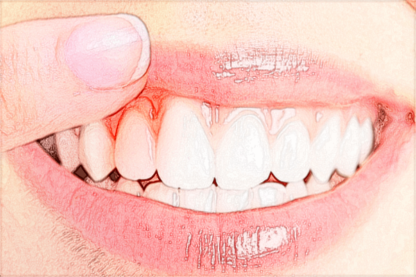 珠海市人民醫(yī)院口腔科黃慧文好嗎?2024口腔科黃慧文收費