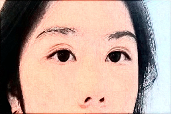 2024哈爾濱醫(yī)科大學附屬第二醫(yī)院全飛秒多少費用？醫(yī)生推薦