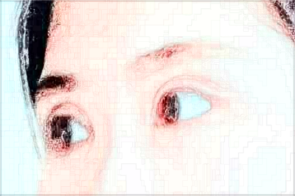 2024蘇州第四人民醫(yī)院近視手術(shù)做的好嗎？哪位醫(yī)生做的好