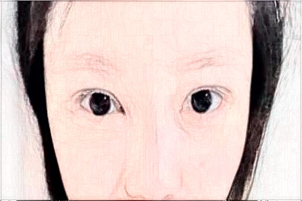 2024天津人民醫(yī)院做的好嗎_醫(yī)生推薦