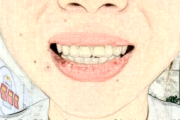 2024天津市口腔醫(yī)院鑲牙技術(shù)好嗎?哪個(gè)大夫好