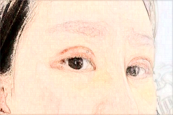 蘇州第四人民醫(yī)院割雙眼皮怎么樣_醫(yī)生名單推薦