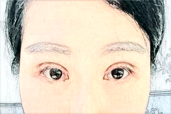 蘇州第四人民醫(yī)院割雙眼皮怎么樣_醫(yī)生名單推薦