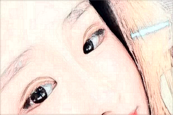 蘇州第四人民醫(yī)院激光去紅血絲多少費(fèi)用？醫(yī)生排名