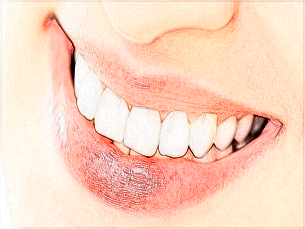 2024中山大學(xué)附屬口腔醫(yī)院洗牙多少錢?洗牙有什么好處