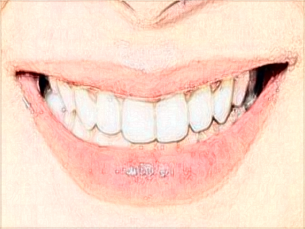 2024中山大學(xué)附屬口腔醫(yī)院洗牙收費標(biāo)準(zhǔn)?洗牙能讓牙變白?