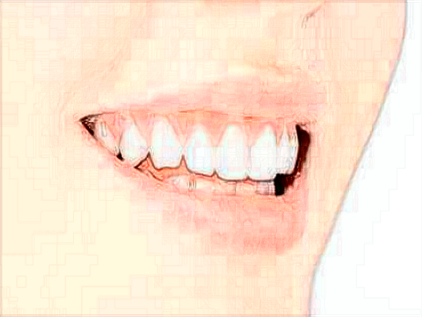 中山大學附屬口腔醫(yī)院洗牙怎么樣?洗牙對牙齒有傷害嗎