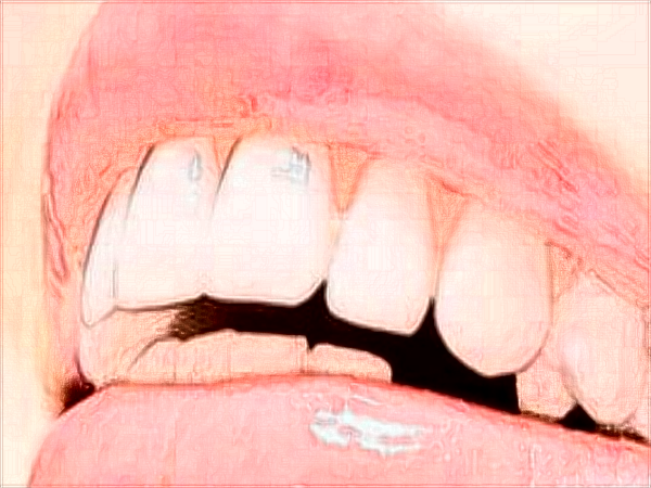 中山大學(xué)附屬口腔醫(yī)院口腔正畸科的范圍?2024正畸科價格