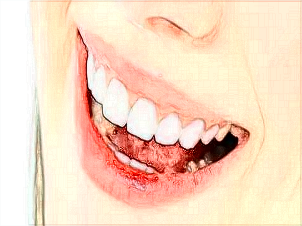 中山大學(xué)附屬口腔醫(yī)院口腔正畸科的范圍?2024正畸科價格