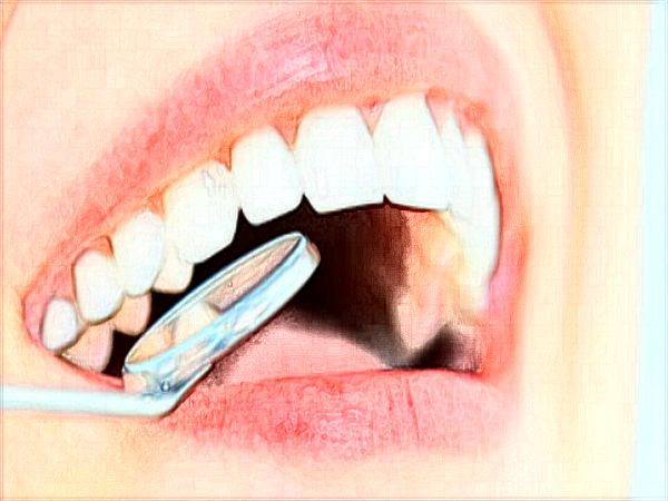 中山大學(xué)附屬口腔醫(yī)院口腔修復(fù)科治什么?可以補(bǔ)牙嗎?