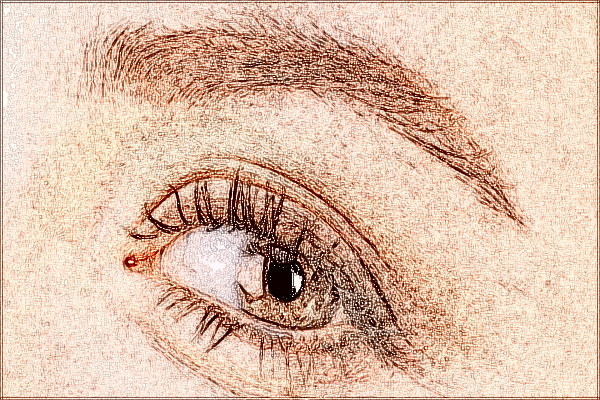 2024中山市人民醫(yī)院全飛秒激光多少錢?全飛秒激光后遺癥