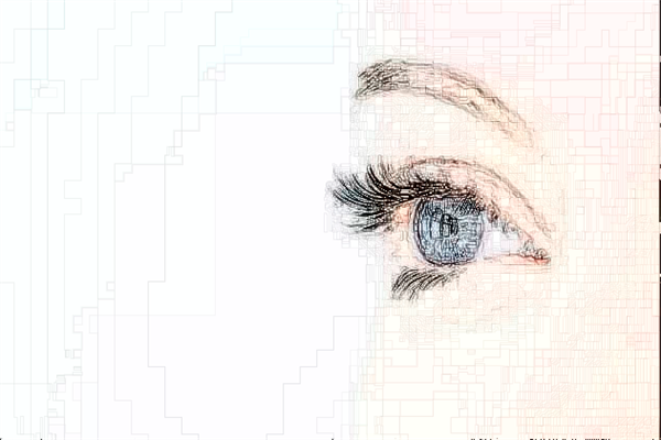 2024泉州180醫(yī)院近視激光手術(shù)多少錢?近視激光手術(shù)是什么