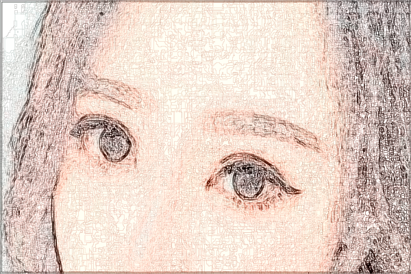 2024珠海市人民醫(yī)院全飛秒手術(shù)多少錢?全飛秒手術(shù)案例