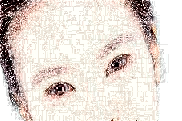 惠州市中心人民醫(yī)院祛眼袋哪種手術(shù)好?祛眼袋手術(shù)嗎