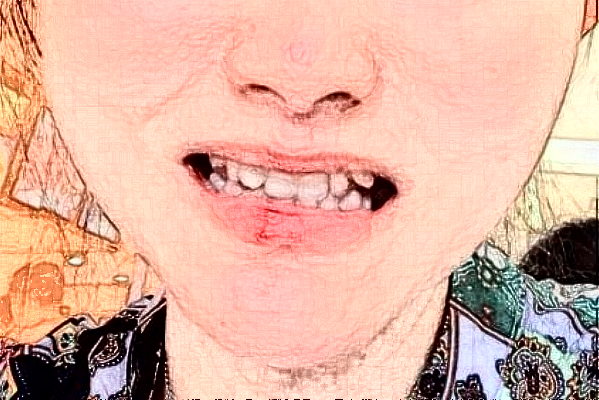 2024常州市第三人民醫(yī)院口腔科牙齒修復(fù)誰做得好_醫(yī)生簡(jiǎn)介