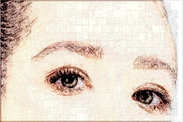 2024青島市立醫(yī)院近視眼手術(shù)費(fèi)用多少?近視眼手術(shù)恢復(fù)期