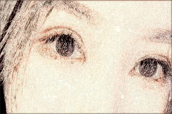 2024泉州180醫(yī)院近視激光手術價格?近視激光手術危害