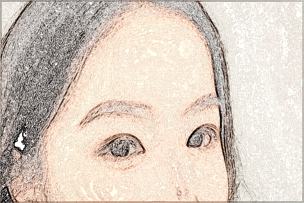 2024泉州180醫(yī)院近視激光手術價格?近視激光手術危害