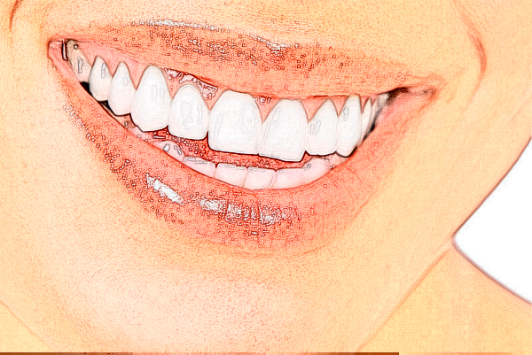 2024蘇州第四人民醫(yī)院牙齒種植做的好嗎？哪位醫(yī)生做的好