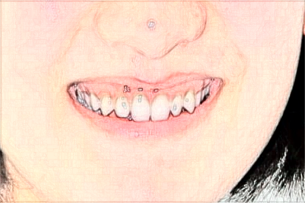 2024南京中大醫(yī)院口腔科口腔正畸做的好嗎？醫(yī)生排名