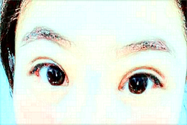 杭州市第一人民醫(yī)院近視激光手術(shù)做的怎么樣？醫(yī)生推薦