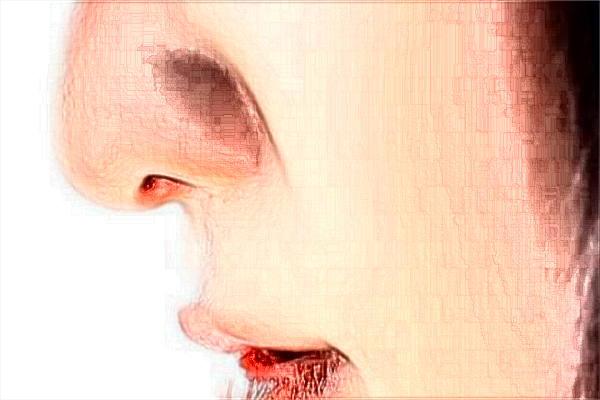 南京鼓樓醫(yī)院熱拉提做的好嗎？誰做的好