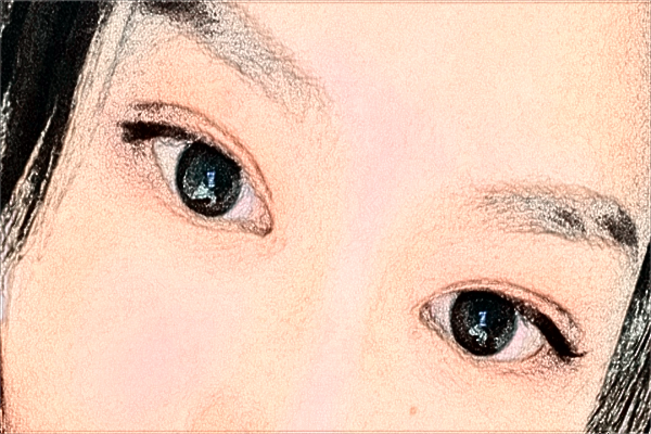 溫州醫(yī)學(xué)院附屬第一醫(yī)院做雙眼皮怎么樣_大概需要多少錢