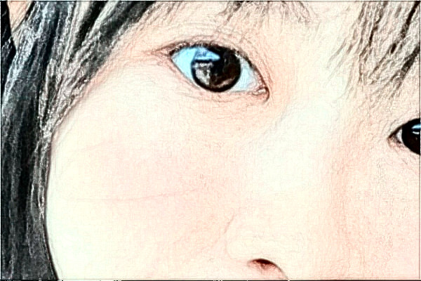 江蘇大學(xué)附屬醫(yī)院激光洗眼線怎么樣?實(shí)測案例分享