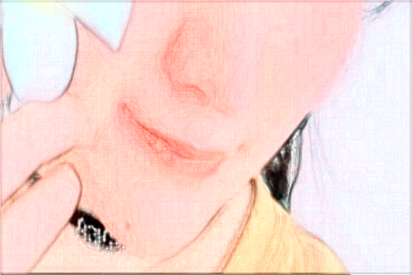 金華市中醫(yī)院光子嫩膚多少費(fèi)用？醫(yī)生排名