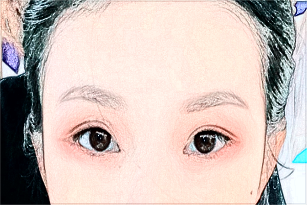 大連大學(xué)附屬中山醫(yī)院近視手術(shù)誰做的好_做的怎么樣