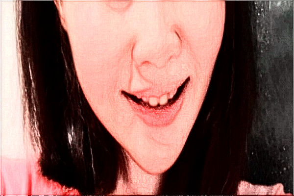 2024溫州醫(yī)學(xué)院附屬第二醫(yī)院口腔科面部不對稱矯正誰做的好