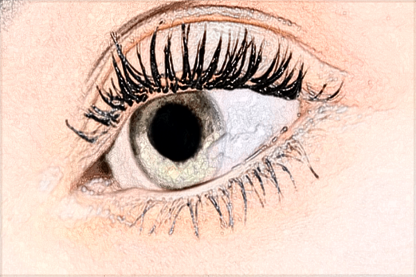 中山大學(xué)附屬第一醫(yī)院近視矯正好嗎?近視矯正有哪些方法