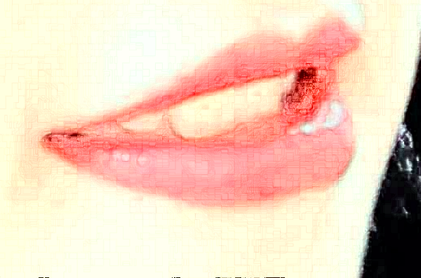 2024大連新華醫(yī)院口腔科全口牙修復(fù)價格表_醫(yī)生推薦