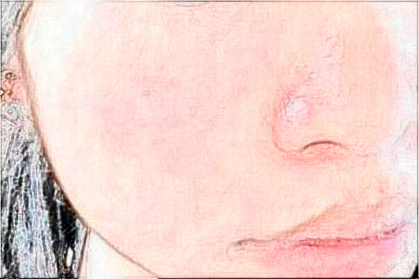 上海東方醫(yī)院祛斑價目表(價格表)怎么樣